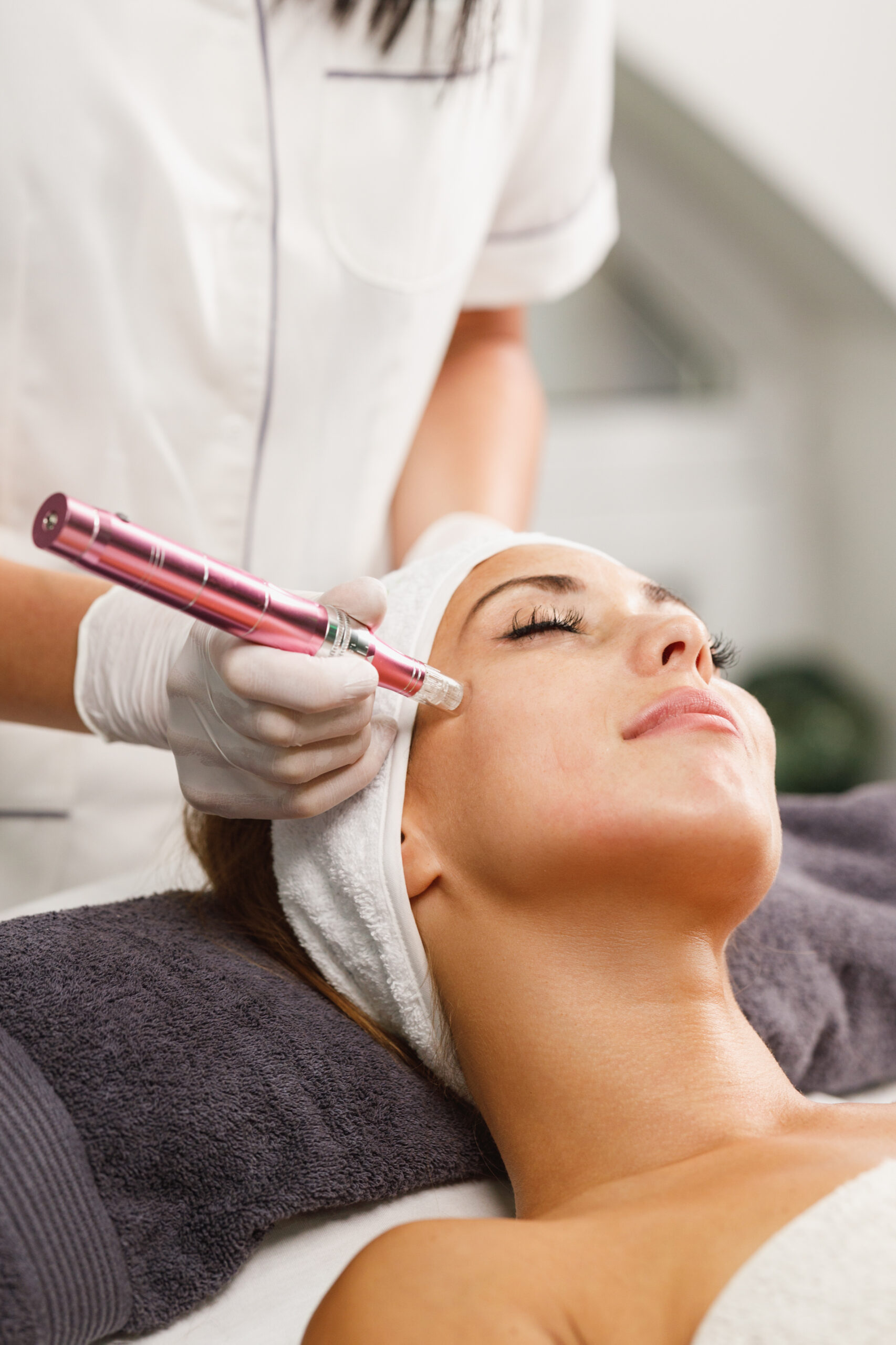 Microneedling