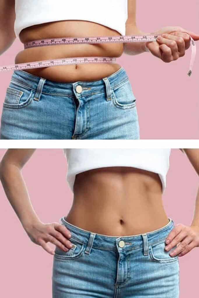 Before and after weight loss stomachs